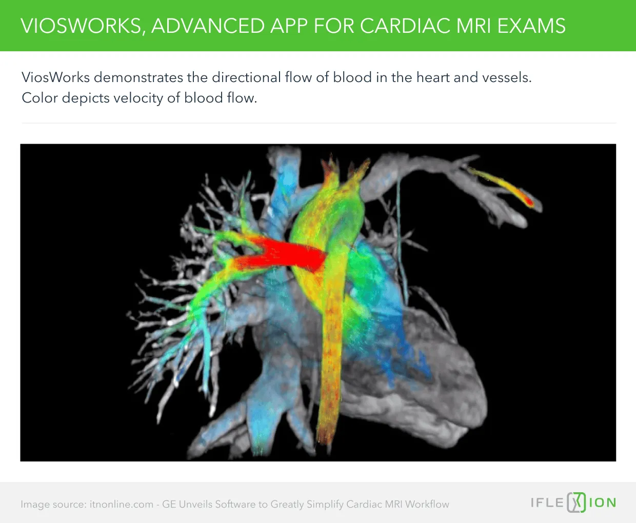 ViosWorks, Advanced App For Cardiac MRI Exams